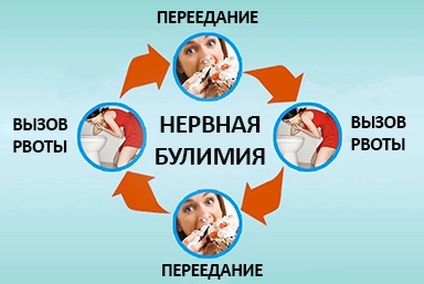Лечение булимии в Югорске